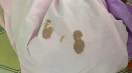 伽罗躺床流白色分泌物图片，惊现职业生涯大危机，引发网友热议与猜测！